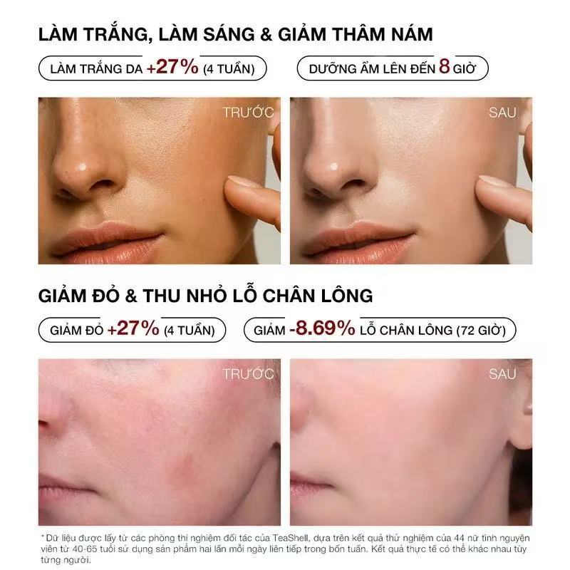 Niacinamide Brightening Serum 30ml - Dark Spot Corrector, Pore Minimizing Vitamin B3 Serum for Even Skin Tone & Hydrated Glow (The Miracle Serum)